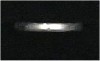 S�lv ring